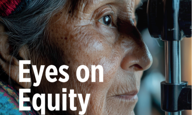 Eyes on Equity